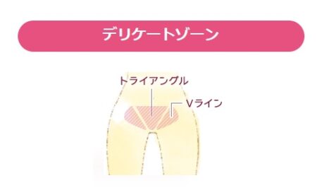 エピレタ　デリケートゾーン　利用　図解